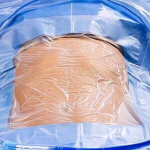 Key Features of C-Section Drapes with Drainage Bags