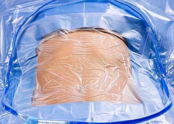 Key Features of C-Section Drapes with Drainage Bags