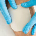 How Do Hydrocolloid Dressings and Silver Sulfadiazine Cream Aid in Wound Care?