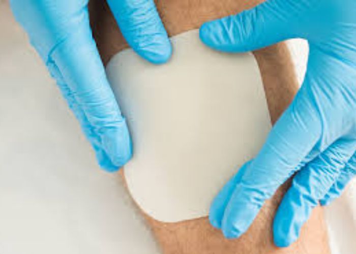 How Do Hydrocolloid Dressings and Silver Sulfadiazine Cream Aid in Wound Care?