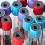 What Are the Different Types of Blood Collection Tubes and Their Uses?