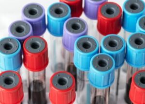 What Are the Different Types of Blood Collection Tubes and Their Uses?